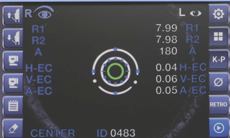 Keratometry Peripheral Measurement