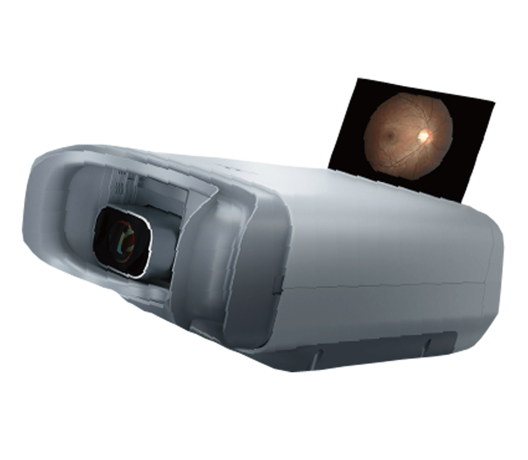 Fundus Camera