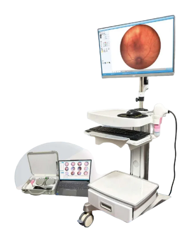 Fundus Camera